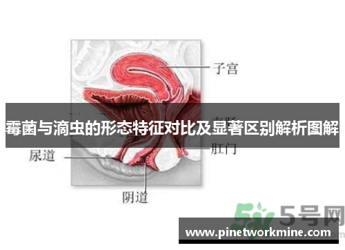 霉菌与滴虫的形态特征对比及显著区别解析图解 霉菌与滴虫的形态特征对比及显著区别解析图解